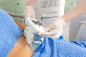 Coolsculpting bei Kiprov in Wien