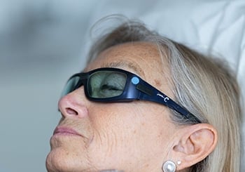 CO2 Laser Wien - Behandlung zur Hautverjüngung